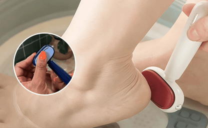 ✨ Foot Callus Remover🦶Remove Hard & Dry Skin